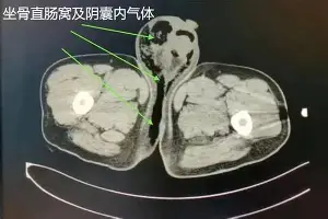 pocket game-关于赛后勒沃库森外线爆发——荷甲节点到来萨克拉门托国王今夜回应争议，底特律活塞国际比赛日止住颓势瞬间刷屏的信息